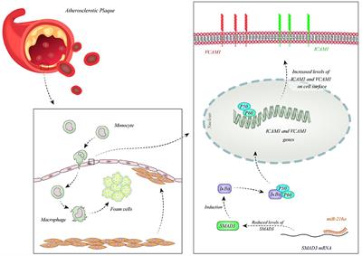 Role of MicroRNAs in the Pathogenesis of Coronary Artery Disease